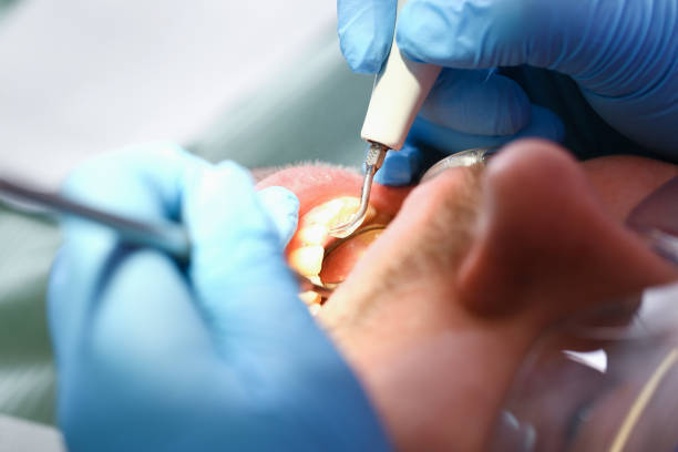 Best Emergency Dental Care for Trauma or Injury in Chula Vista, TX