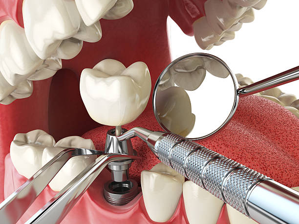Best Emergency Dental Care for Trauma or Injury in Chula Vista, TX