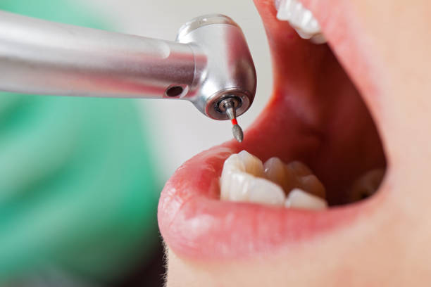 Best Emergency Dental Surgery in Chula Vista, TX